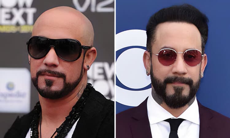 A. J. McLean Hair Transplant