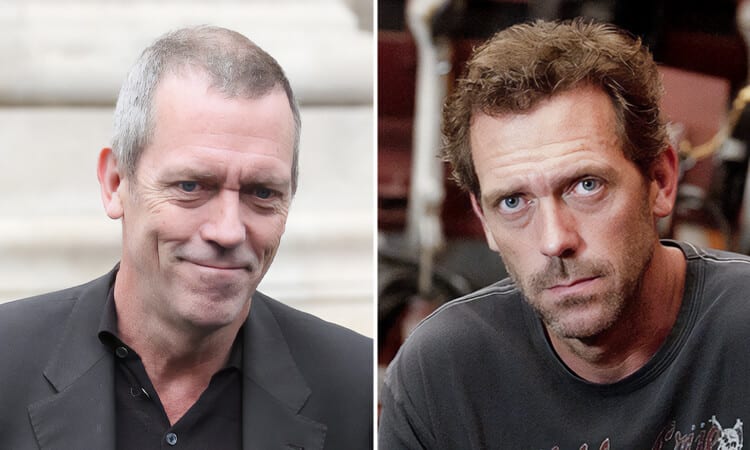 Hugh Laurie Hair Transplant