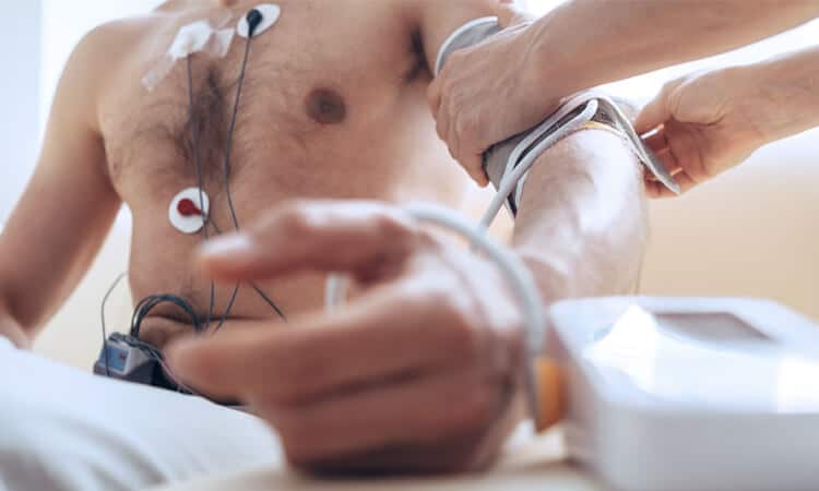 ekg test before a hair transplant