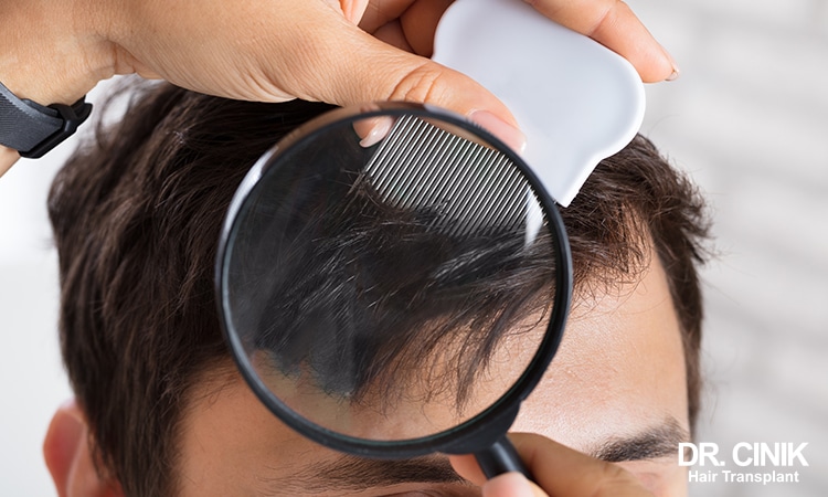 inspecting a male patient for head lice and scabs on the scalp