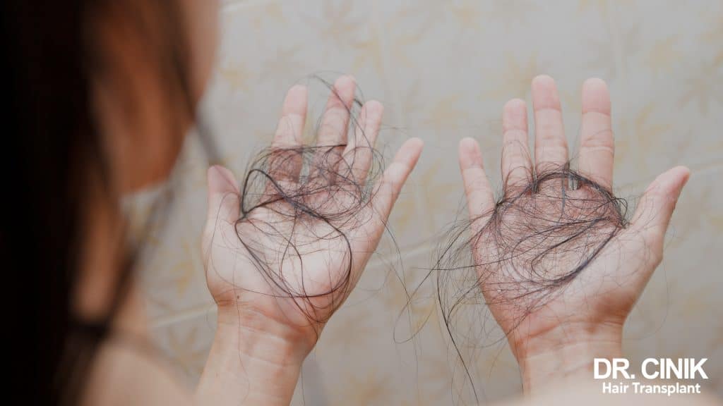 A woman who is losing her hair, likely due to post-menopausal alopecia