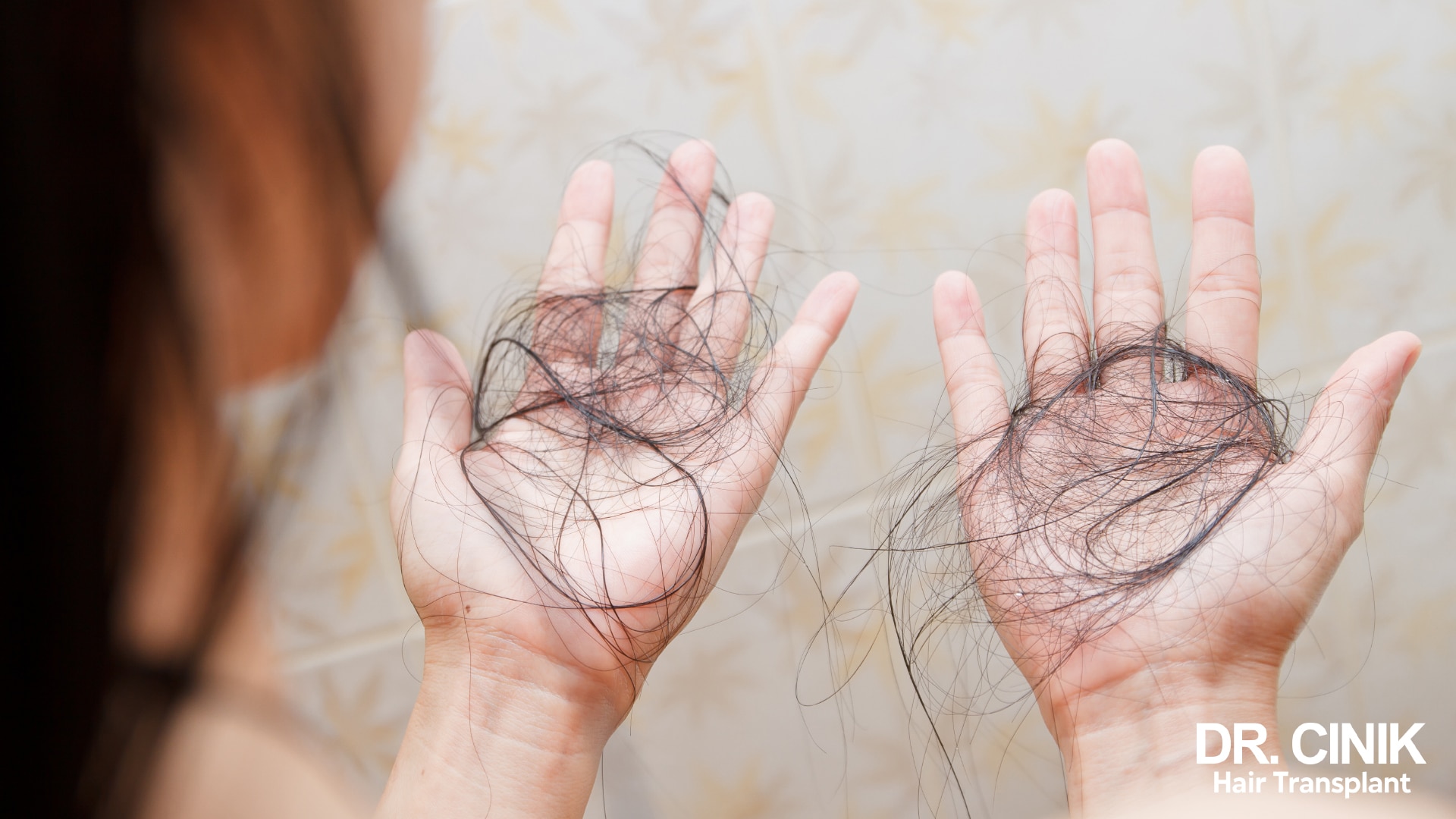 A women loosing her hair