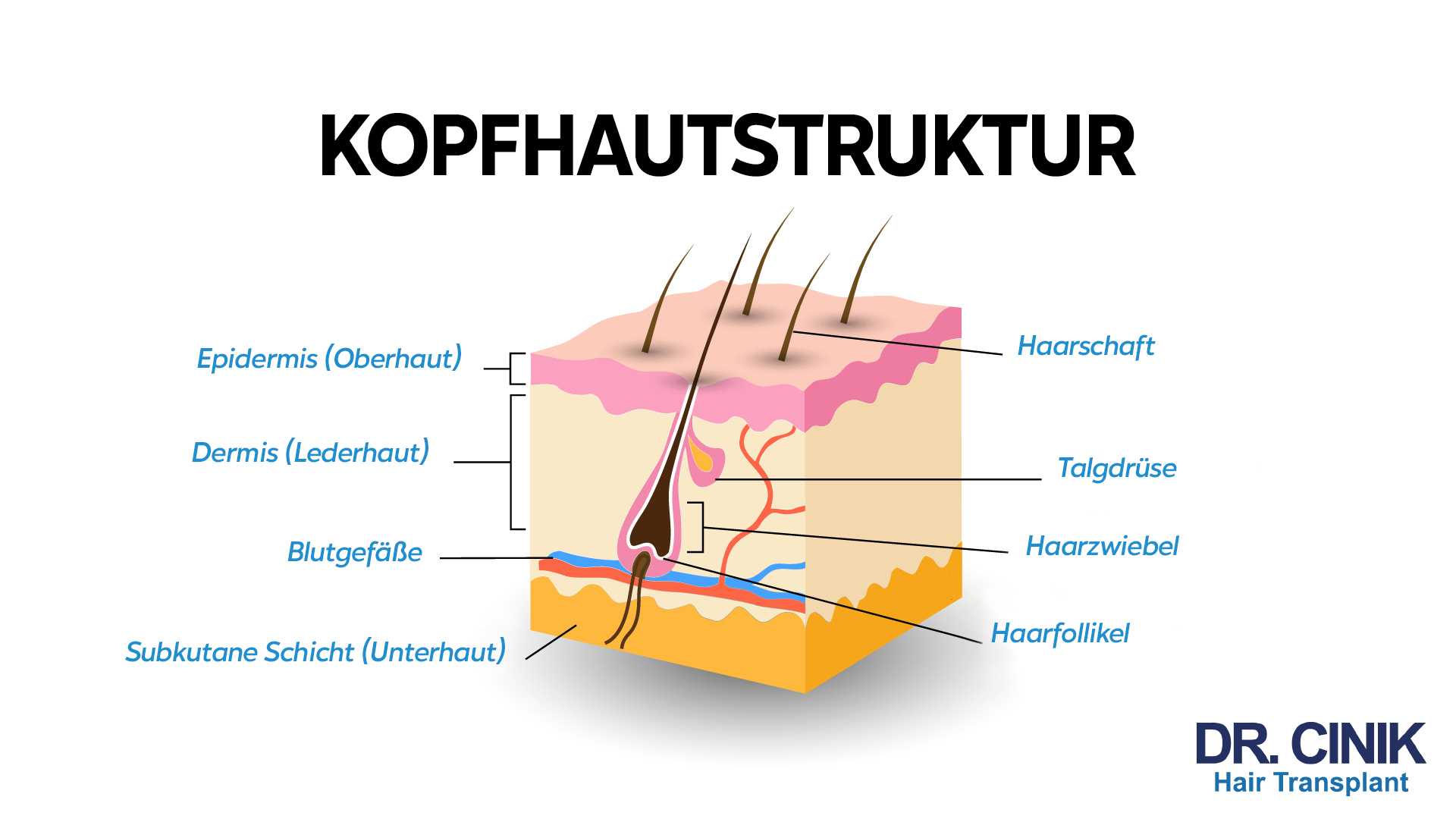 Diagramm der Kopfhautstruktur. Ein Querschnitt zeigt die Schichten und Elemente der Haut: Epidermis (Oberhaut), Dermis (Lederhaut), Blutgefäße, Subkutane Schicht (Unterhaut), Hohlräume für Haarschaft, Talgdrüse, Haarzwiebel und Haarfollikel. Das Ganze wird präsentiert mit dem Logo von DR. CINIK Hair Transplant.