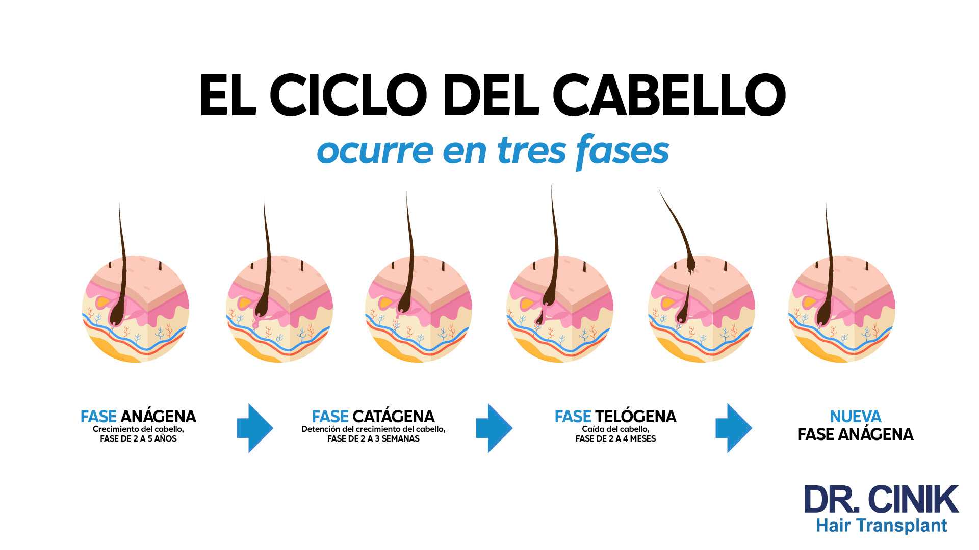 Ilustración que muestra diferentes fases del ciclo del cabello con texto grande central "EL CICLO DEL CABELLO" y debajo "ocurre en tres fases". Se visualizan folículos pilosos en diferentes etapas: "Fase Anágena" con crecimiento activo del cabello y fondo colorido que muestra células en actividad con "Crecimiento del cabello, FASE DE 2 A 5 AÑOS"; "Fase Catágena" con detención del crecimiento del cabello y "FASE DE 2 A 3 SEMANAS"; "Fase Telógena" con caída del cabello y "FASE DE 2 A 4 MESES"; y "Nueva Fase Anágena". A la derecha inferior, el logo "DR. CINIK Hair Transplant".