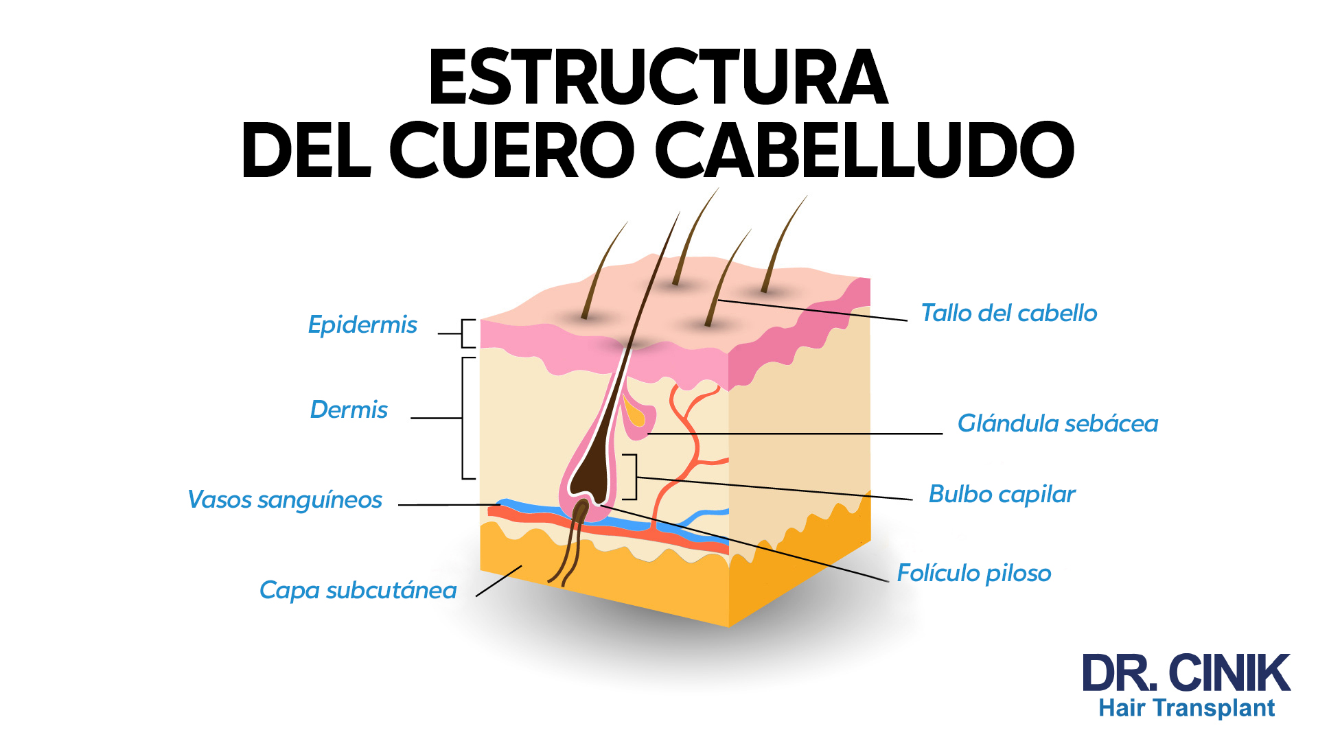 Una ilustración detallada de la estructura del cuero cabelludo. Se muestra un corte transversal del cuero cabelludo que destaca las diferentes capas y elementos. Estos incluyen la epidermis, dermis, vasos sanguíneos y la capa subcutánea. Además, se señalan características específicas del cabello como el tallo del cabello, la glándula sebácea, el bulbo capilar y el folículo piloso. El título 'ESTRUCTURA DEL CUERO CABELLUDO' aparece en la parte superior y el logotipo 'DR. CINIK Hair Transplant' en la esquina inferior derecha.